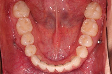 부산교정잘하는치과