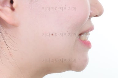 부산교정전문의