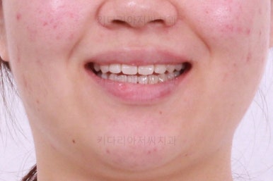 부산치아교정치과