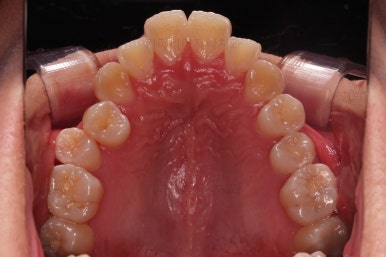 부산치아교정잘하는치과