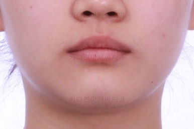 연산동교정치과