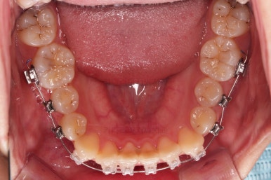 연산동교정치과