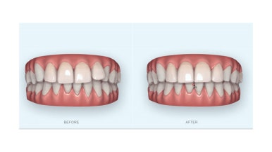 연산동부분교정