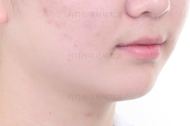 부산치아교정잘하는곳