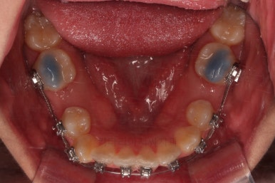 연산동치아교정치과