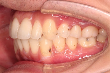 부산연제구교정