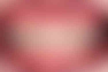 부산치아교정잘하는곳