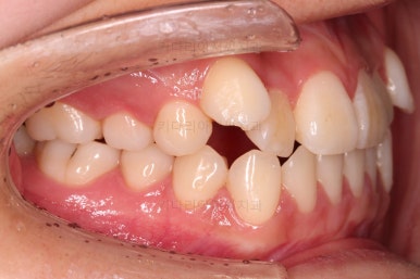 연산동교정치과