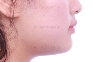 부산교정치과추천