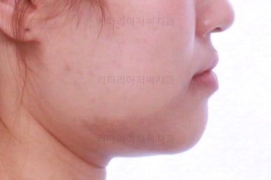 부산치아교정잘하는곳