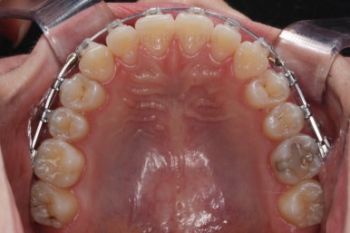 부산치아교정잘하는곳