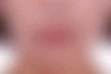 부산연산동교정치과