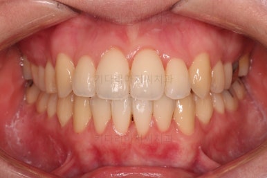 부산치아교정잘하는곳