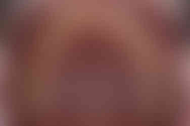 연산동치아교정