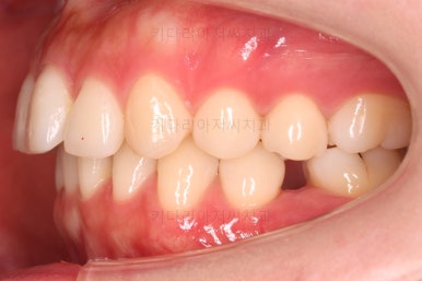 부산인비절라인