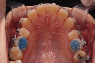 부산무턱교정치과