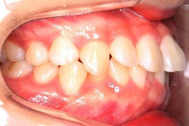 연산동교정치과