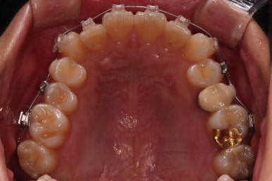 연산동교정치과