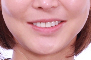 연산동부분교정