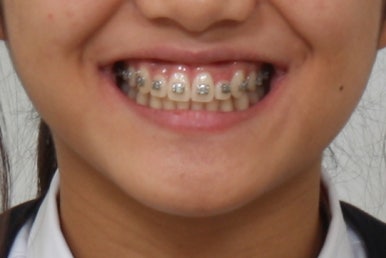 부산연산동청소년교정