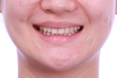 부산인비절라인