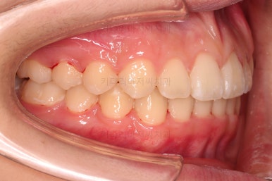 부산교정전문의