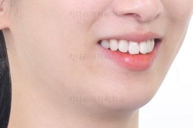 부산연산동부분교정