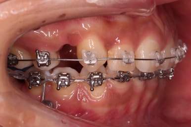 연산동교정치과