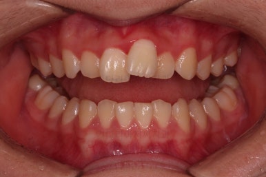 부산청소년교정치과