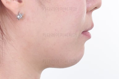 연산동교정치과