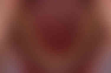 연산동교정치과