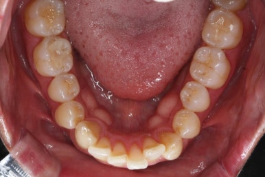 부산교정치과추천