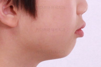 부산어린이교정