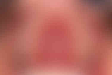 부산치아교정잘하는곳