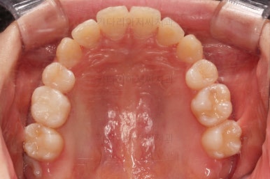 부산교정전문의