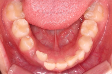 부산어린이교정