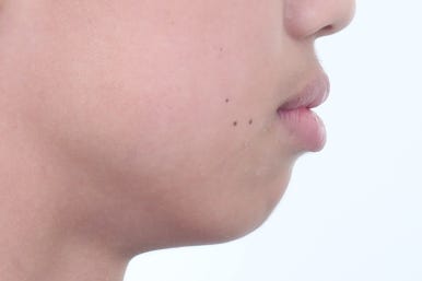부산치아교정전문의