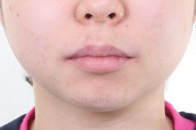 부산연산동교정치과