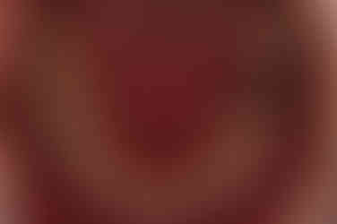 부산임플란트교정