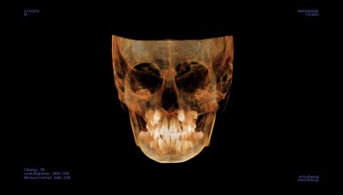 부산어린이교정