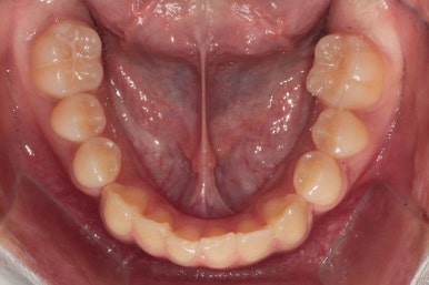 부산연산동청소년교정