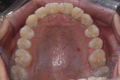 부산연산동청소년교정