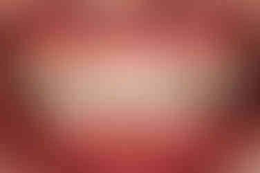 부산임플란트교정