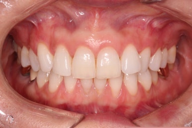 연산동부분교정