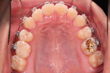 연산동치아교정치과