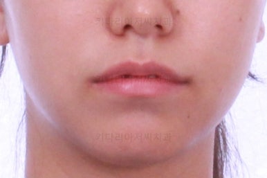 부산교정잘하는치과