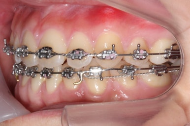 부산교정전문의
