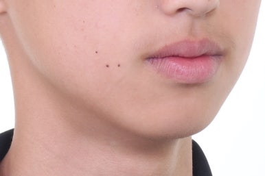 부산치아교정전문의