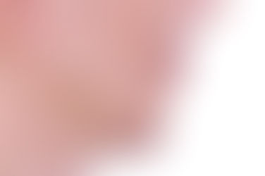 부산구순구개열교정