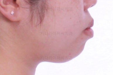 부산교정전문치과